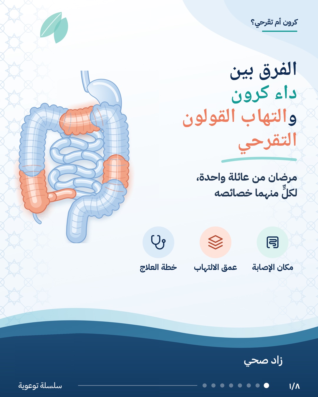 الفرق بين داء كرون والتهاب القولون التقرحي، الشريحة 1 من 8