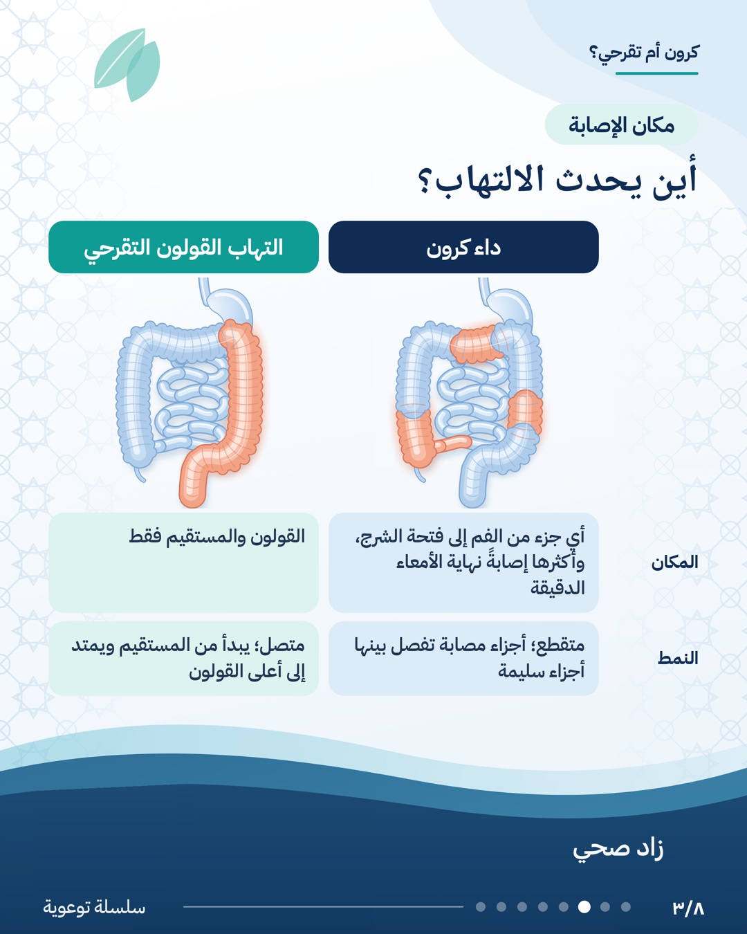 الفرق بين داء كرون والتهاب القولون التقرحي، الشريحة 3 من 8