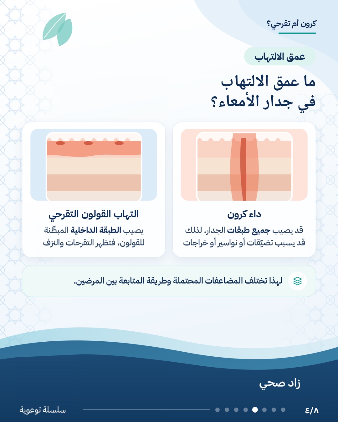 الفرق بين داء كرون والتهاب القولون التقرحي، الشريحة 4 من 8